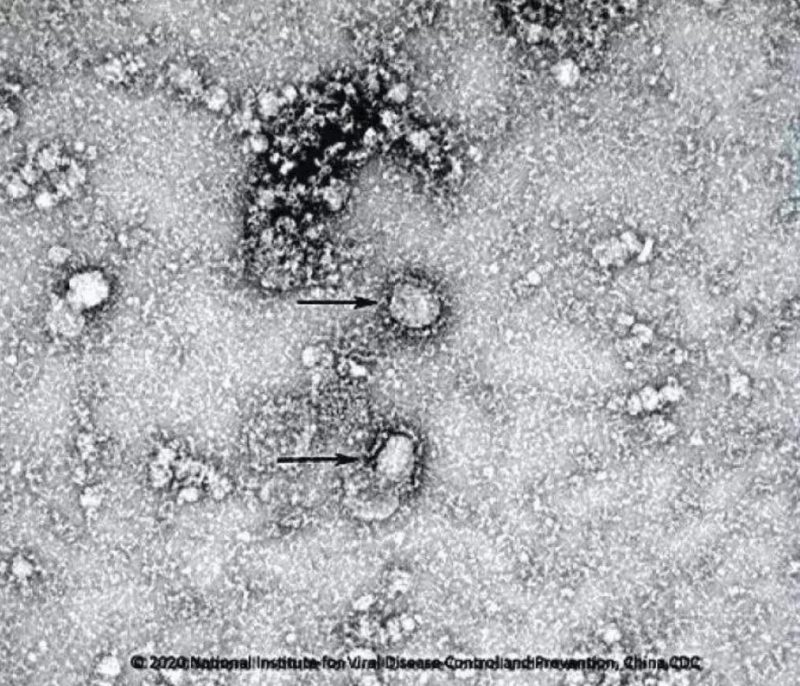 ▲新型冠狀病毒武漢株01。照片來源：國家病原微生物資源庫（中國疾病預(yù)防控制中心病毒病預(yù)防控制所）